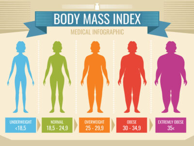 sleep apnea woman body mass index vector medical infographic